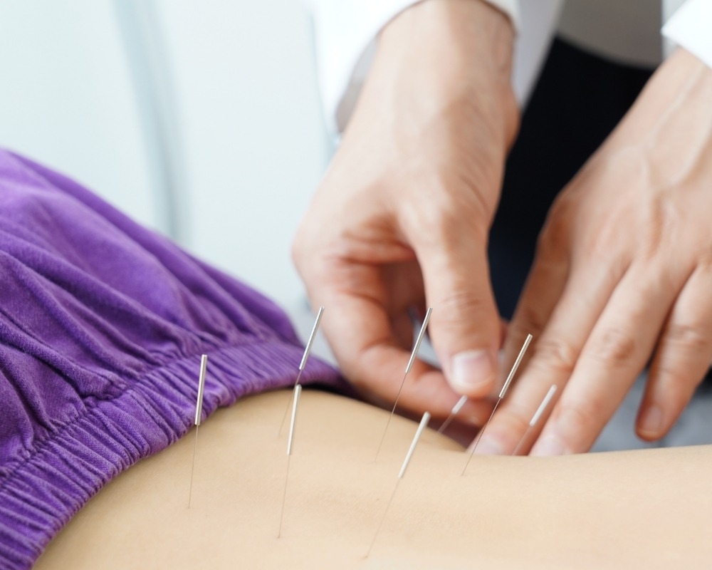 Acupuntura para Ansiedade e Dor