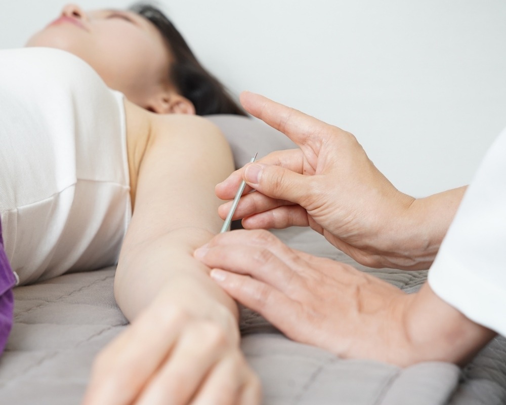 Acupuntura para Ansiedade e Dor